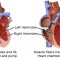 Heart attacks: Injured hearts can be revived with stem cells instead of drugs
