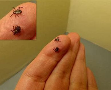 US ticks spread: Tick viruses cause neurological damage, one in ten  10 people die of brain inflammation