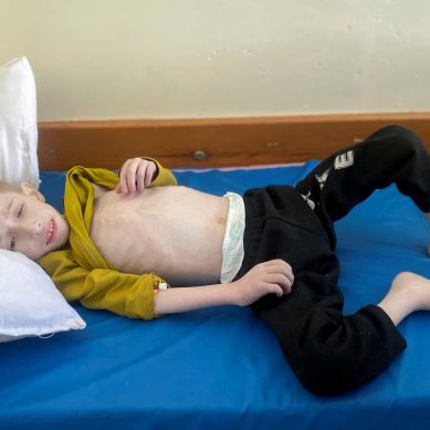 Starving children fill hospital wards as famine looms in Gaza and puts 1.1 million lives at risk