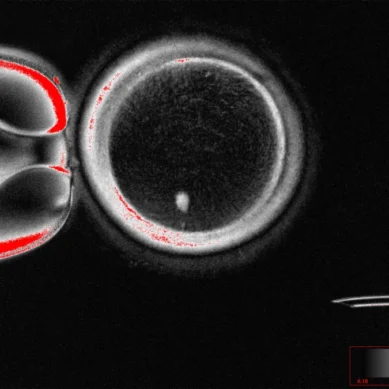 Scientists at Oregon Health and Science University create human eggs from skin cells, use them to form embryos