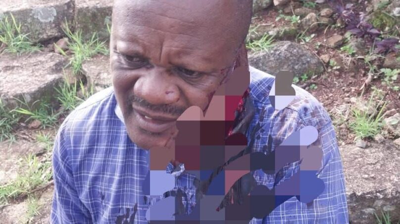 Mental health patent goes on rampage in Vihiga and stabs three people, among them area chief
