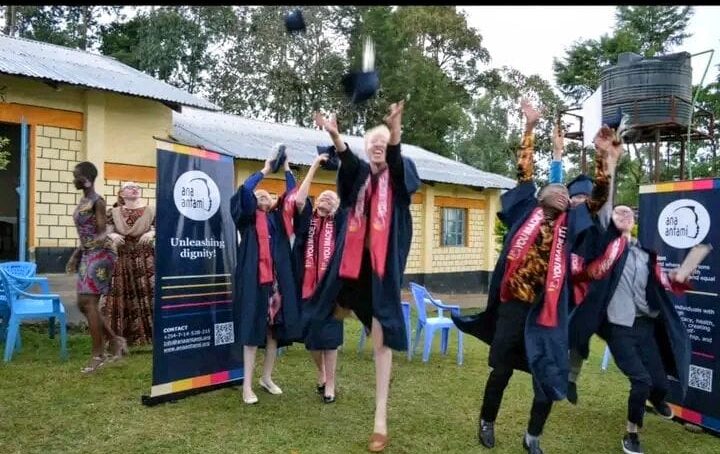 From pain to purpose: Ana Antami College for People with Albinism in Malava, western Kenya, sets high bar for rest of the world