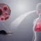Understanding origins, spread of hantavirus, the illness suspected in a cruise ship outbreak