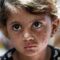 Sewage swamps and dilapidated tents typify lives of displaced Gazans plagued by skin diseases