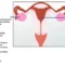 New WHO report funds close link infertility in women, poor sperm quality and sexual dysfunction in men to tobacco smoking